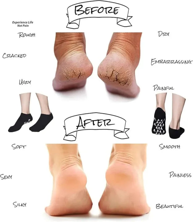 Premium Moisturizing Gel Sock | Ultra-Soft Spa Socks for Repairing Dry Cracked Feet and Heels